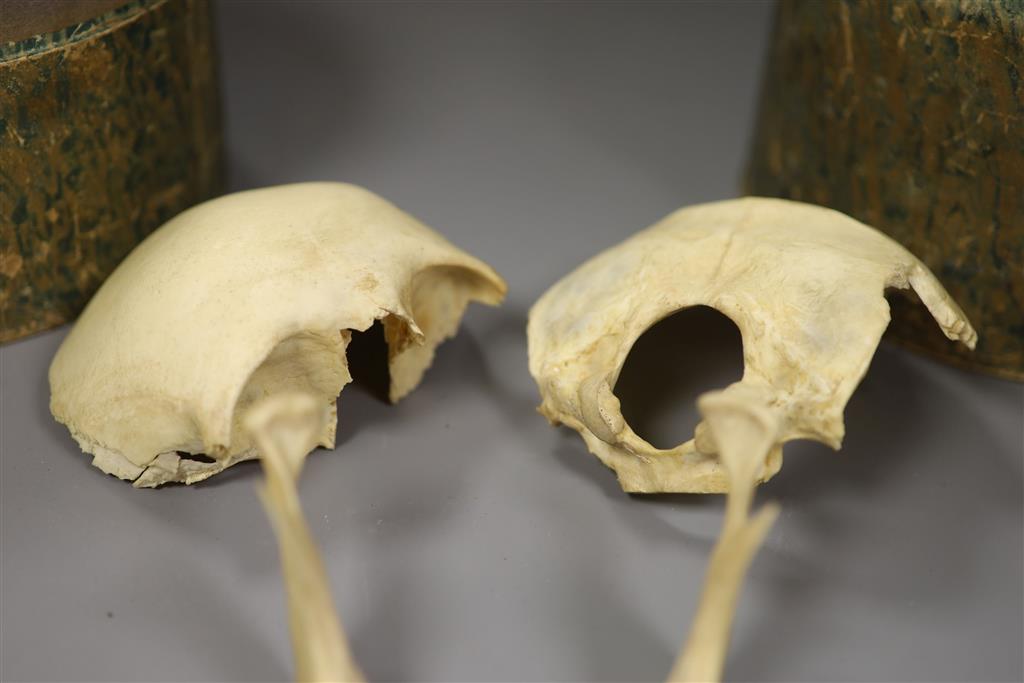 A Victorian disarticulated human skull in original tiered box